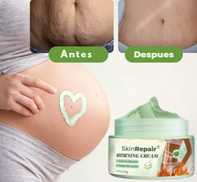 CREMA ANTIESTRÍAS SKINREPAIR